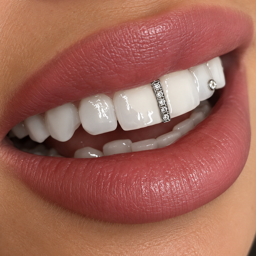 Grillz Gold Premium – Diamond Lattice