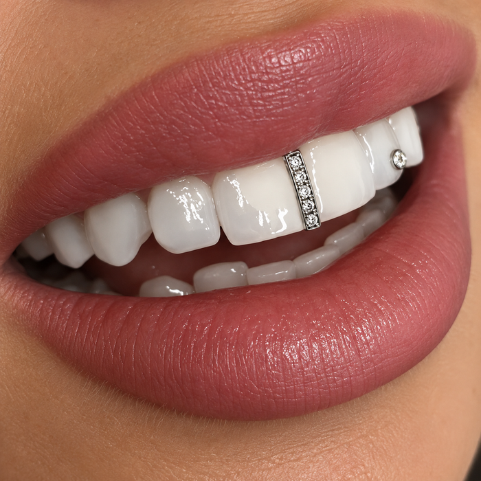 Grillz Gold Premium – Diamond Lattice
